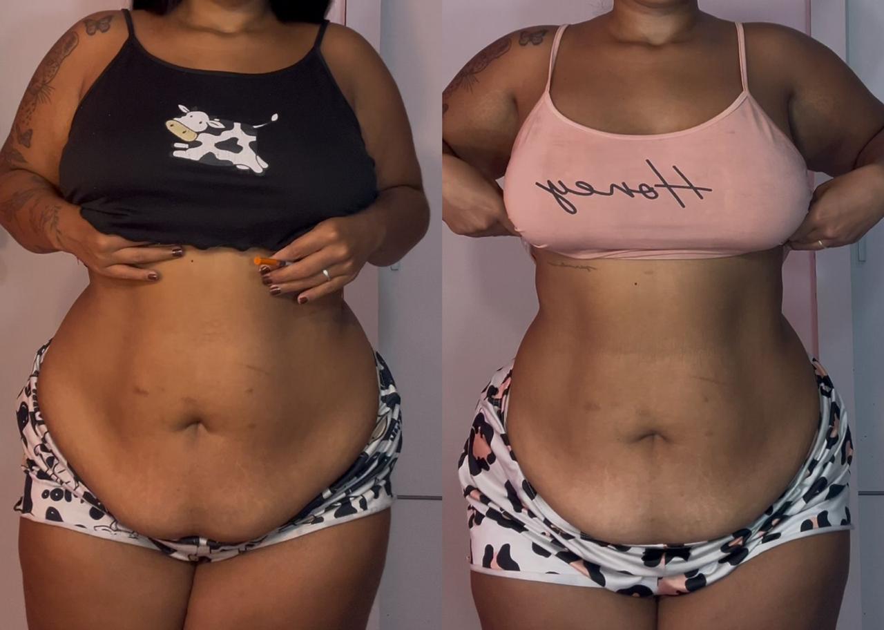 Ana P. - transformação